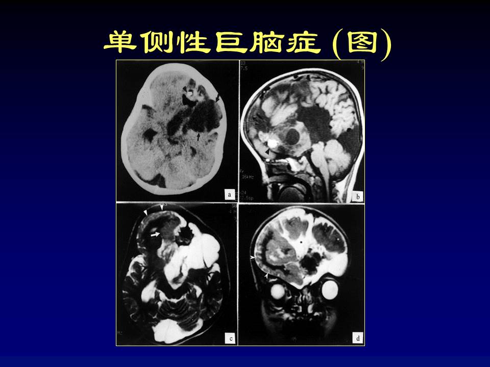 幻灯片42