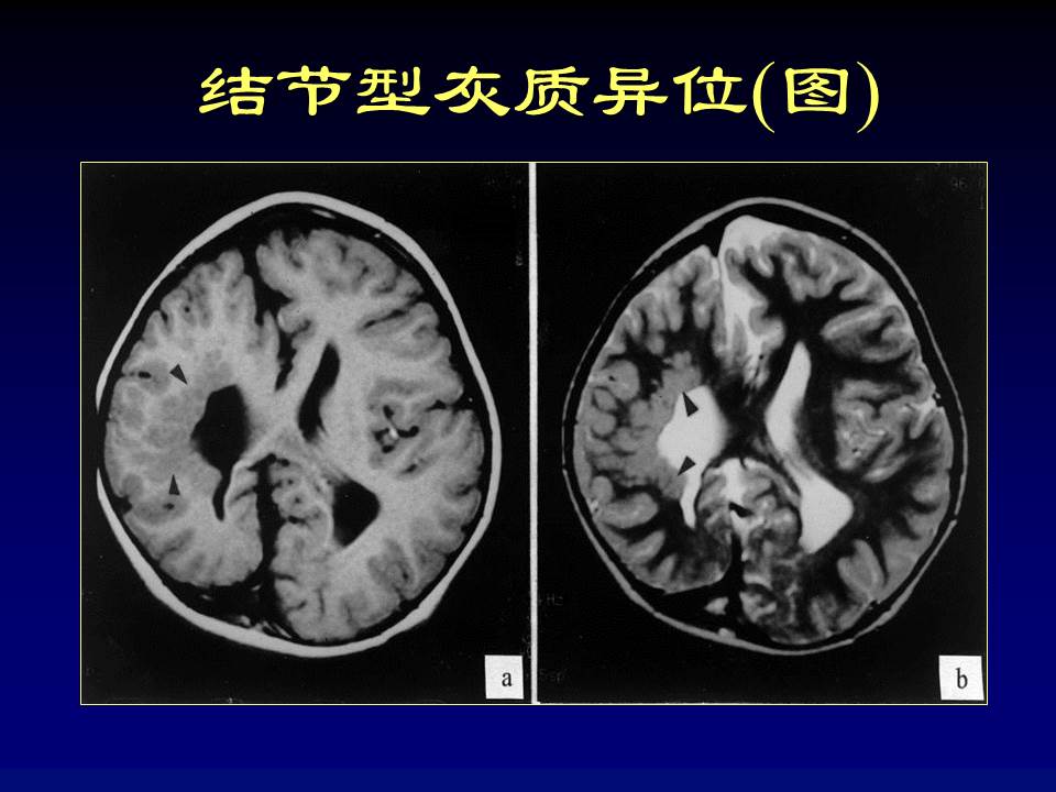 幻灯片46