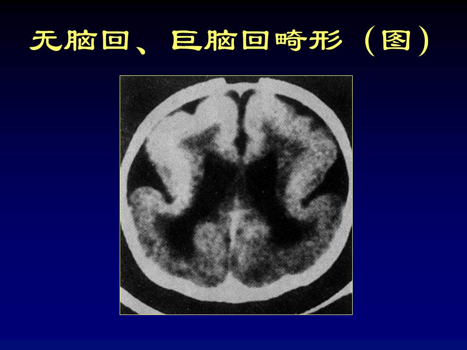 幻灯片39