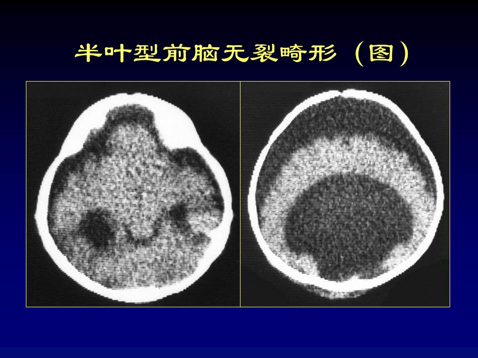 幻灯片59