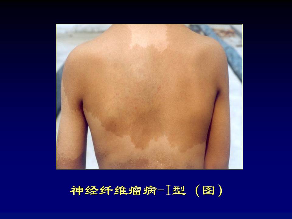 幻灯片83