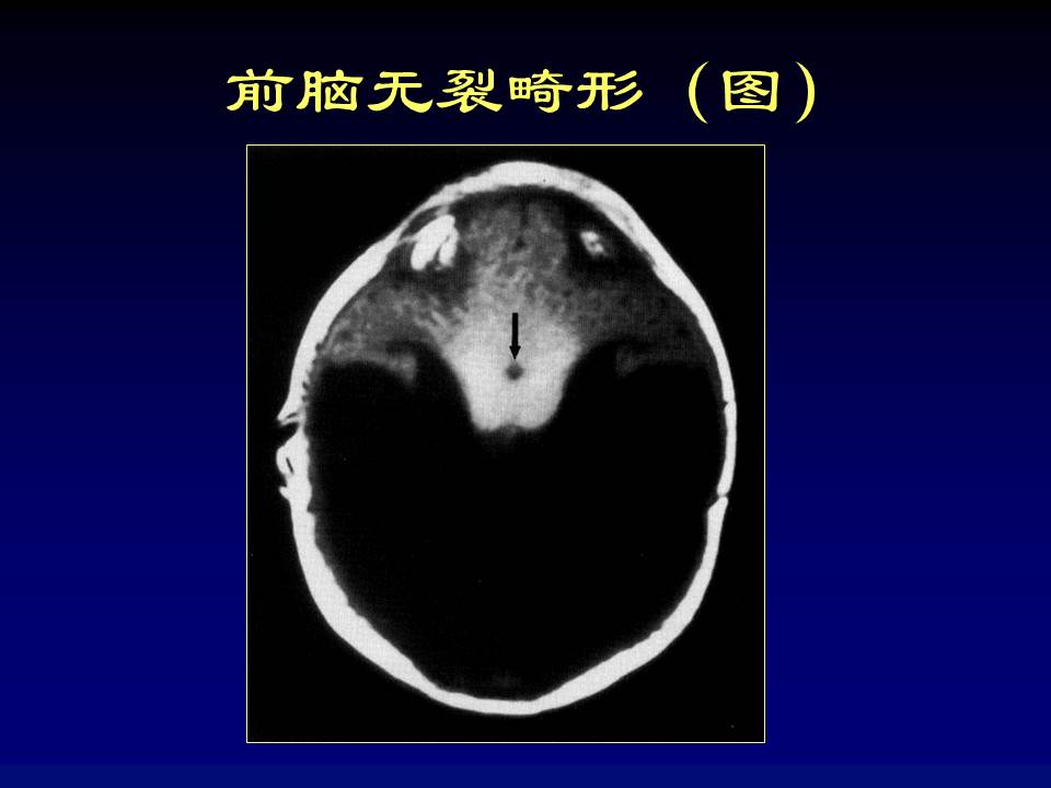 幻灯片58