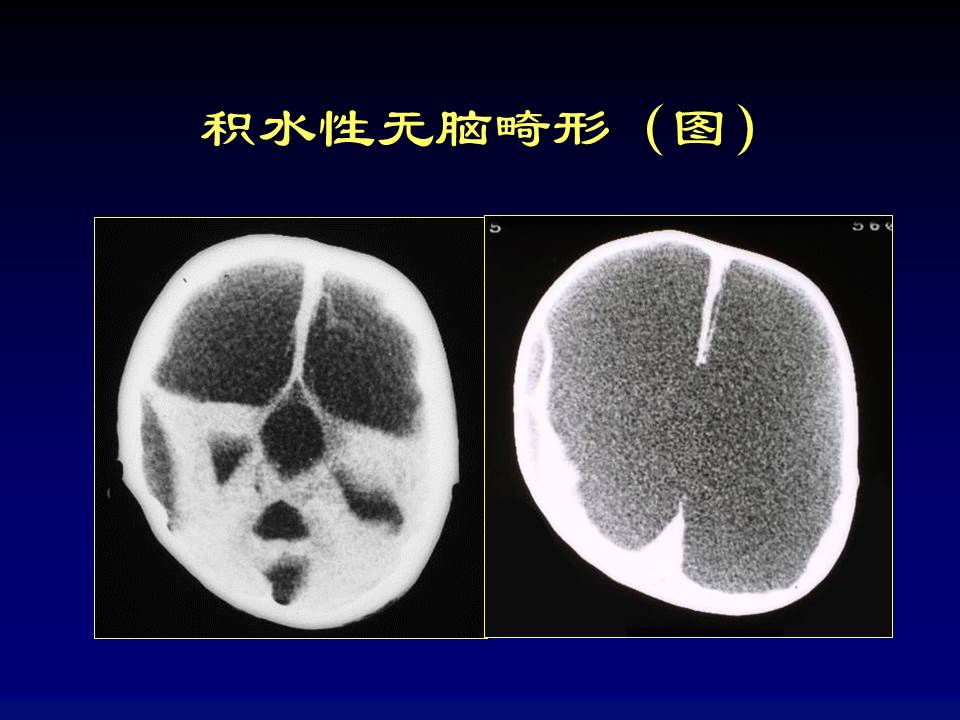 幻灯片66