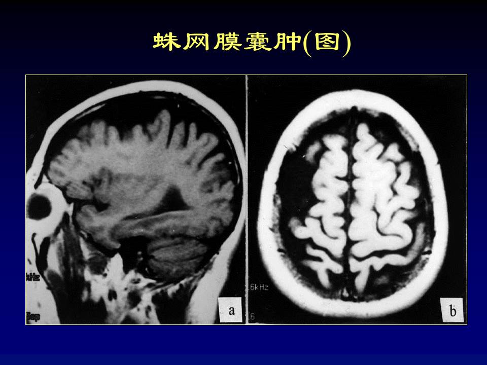 幻灯片73