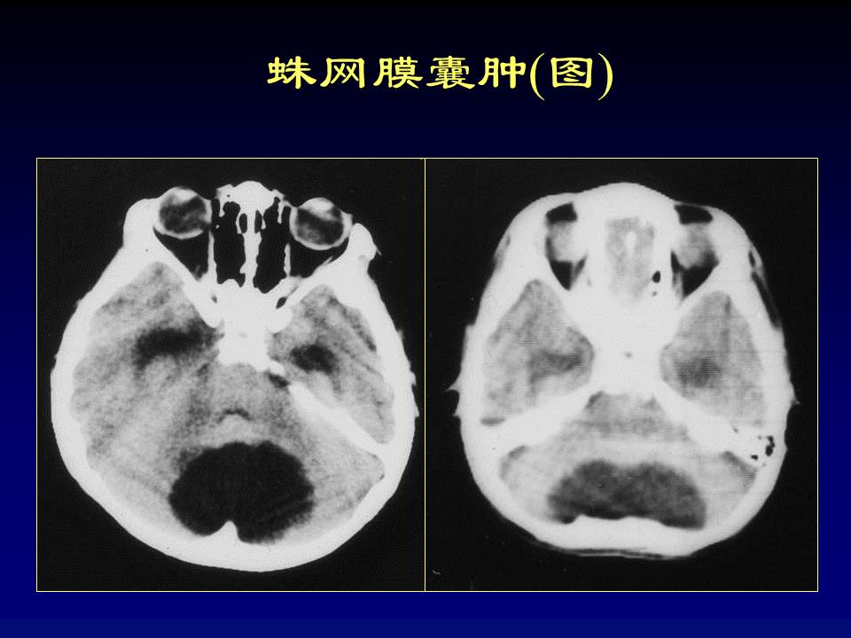 幻灯片74