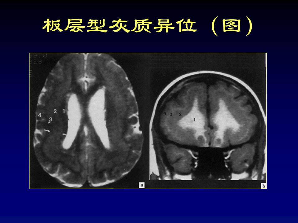 幻灯片48