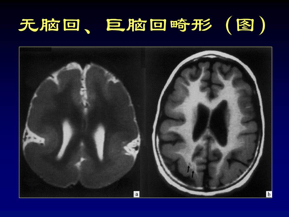 幻灯片40