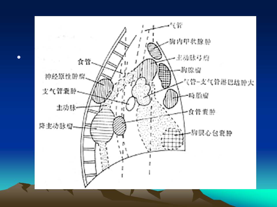 幻灯片4