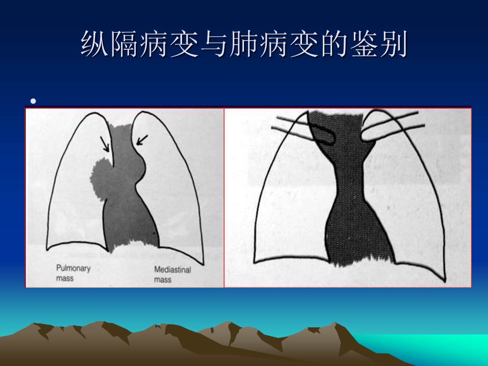 幻灯片6
