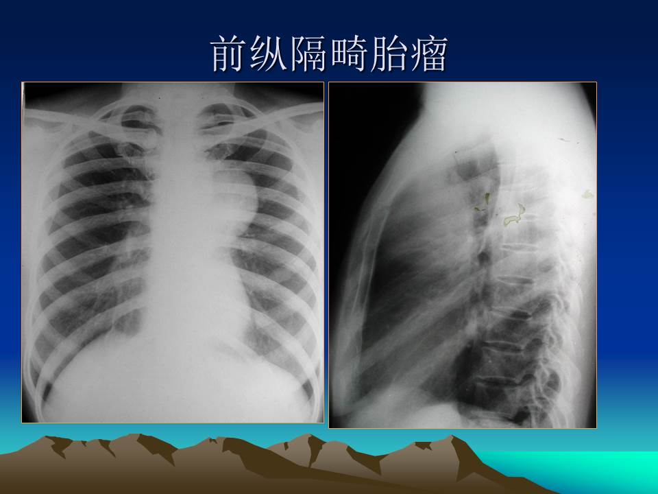 幻灯片32