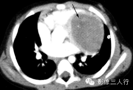 自动草稿