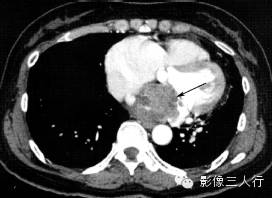 自动草稿