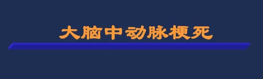 从梗死部位推测责任血管：脑血管解剖-31