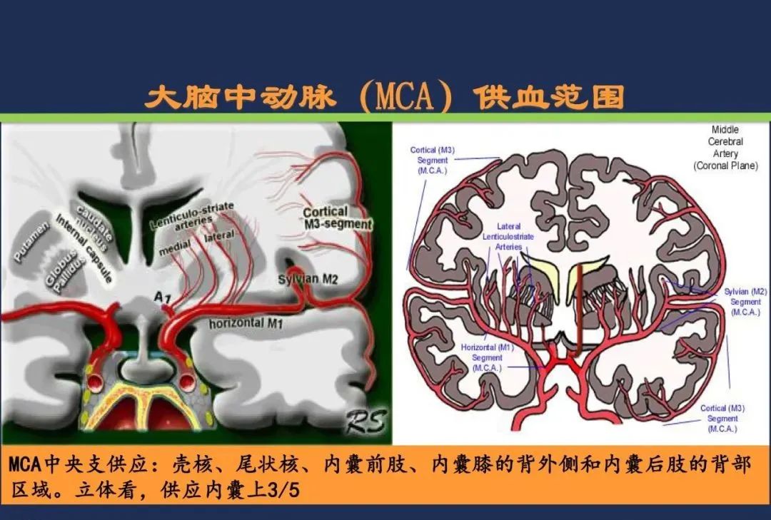从梗死部位推测责任血管：脑血管解剖-33