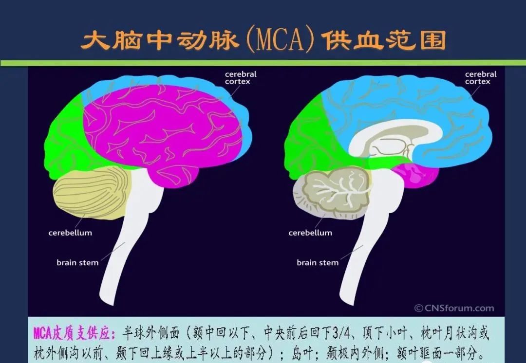 从梗死部位推测责任血管：脑血管解剖-32