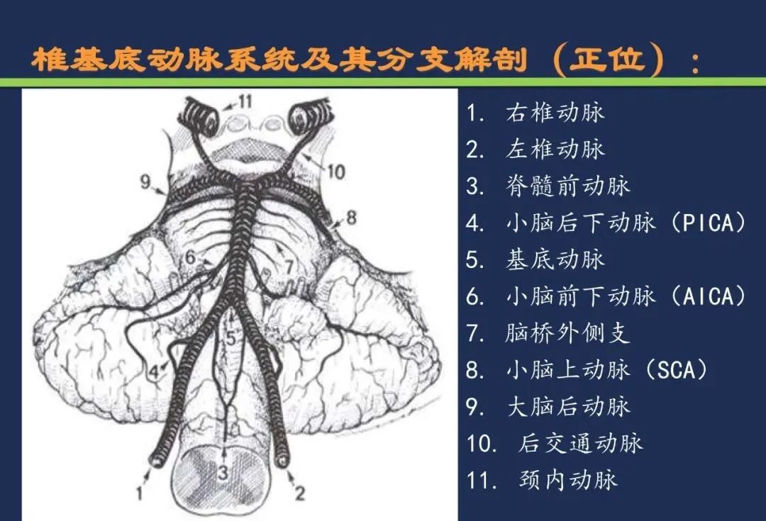 从梗死部位推测责任血管：脑血管解剖-85