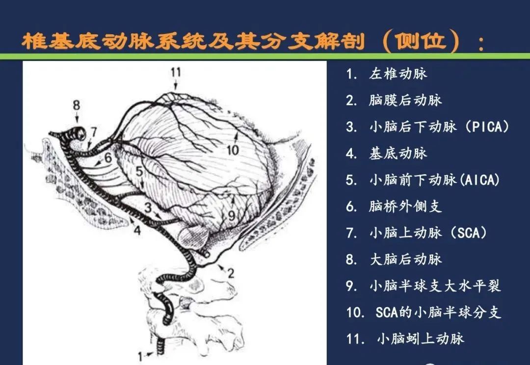 从梗死部位推测责任血管：脑血管解剖-84