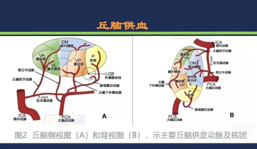 从梗死部位推测责任血管：脑血管解剖-99