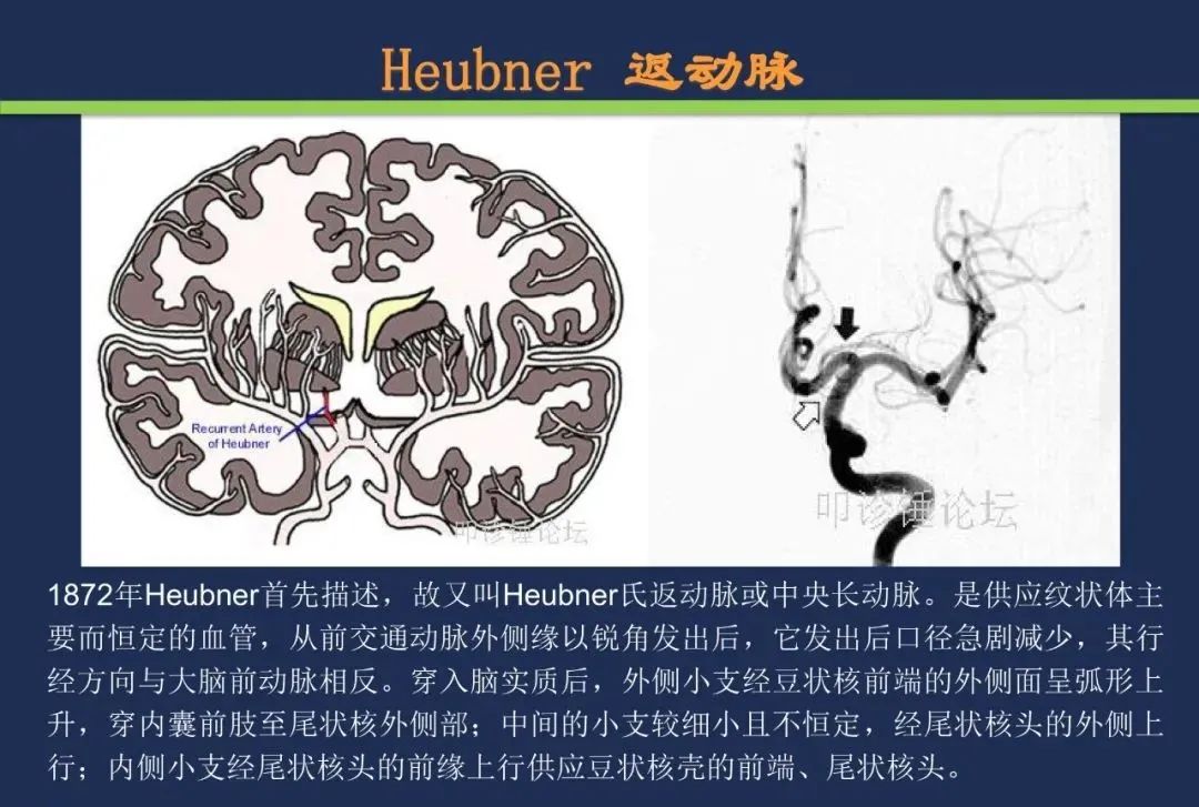 从梗死部位推测责任血管：脑血管解剖-66