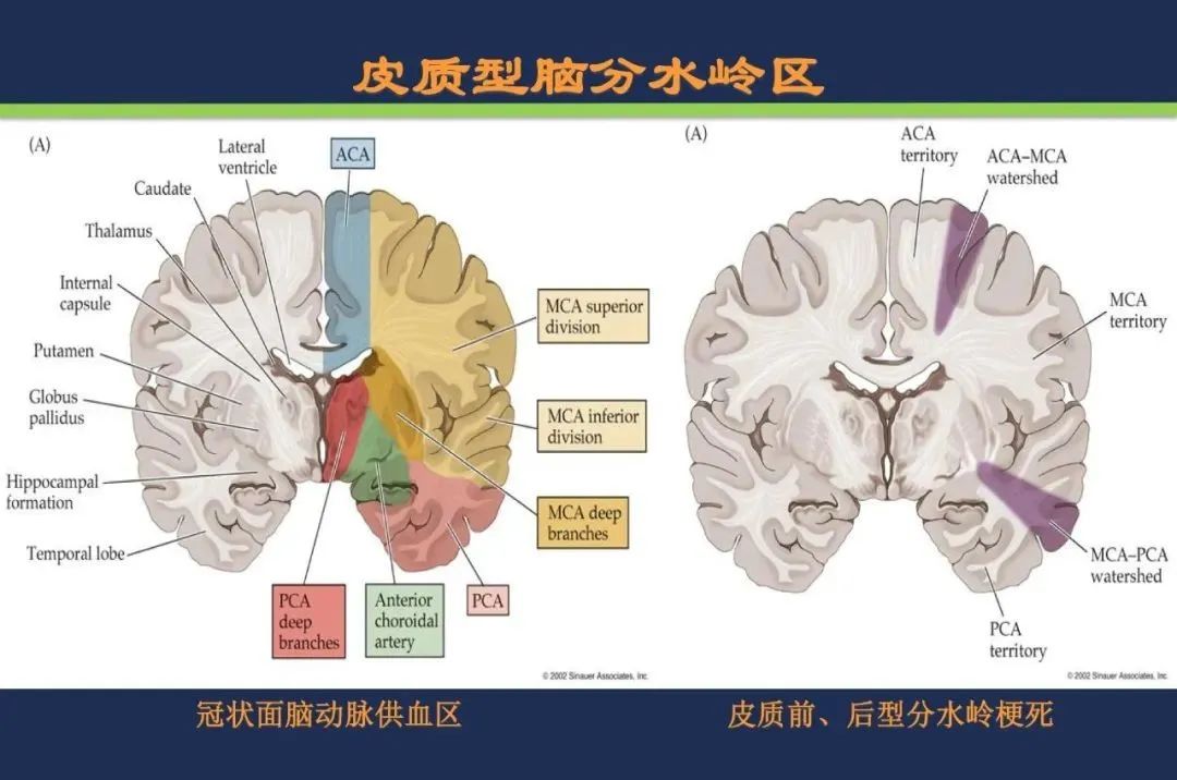 从梗死部位推测责任血管：脑血管解剖-240