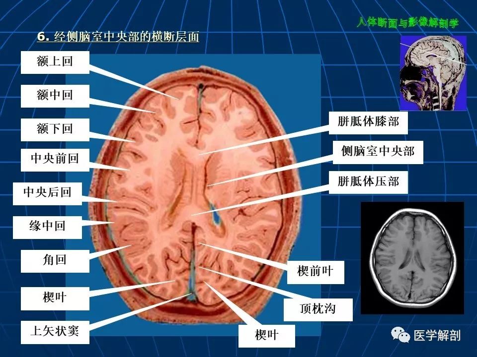 颅脑大体及磁共振断层解剖