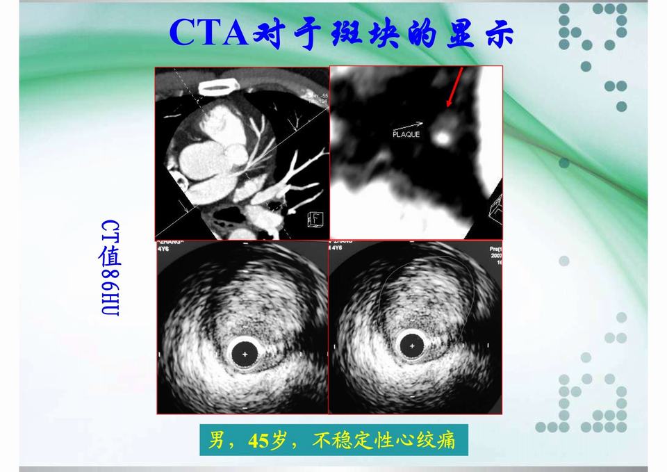图13