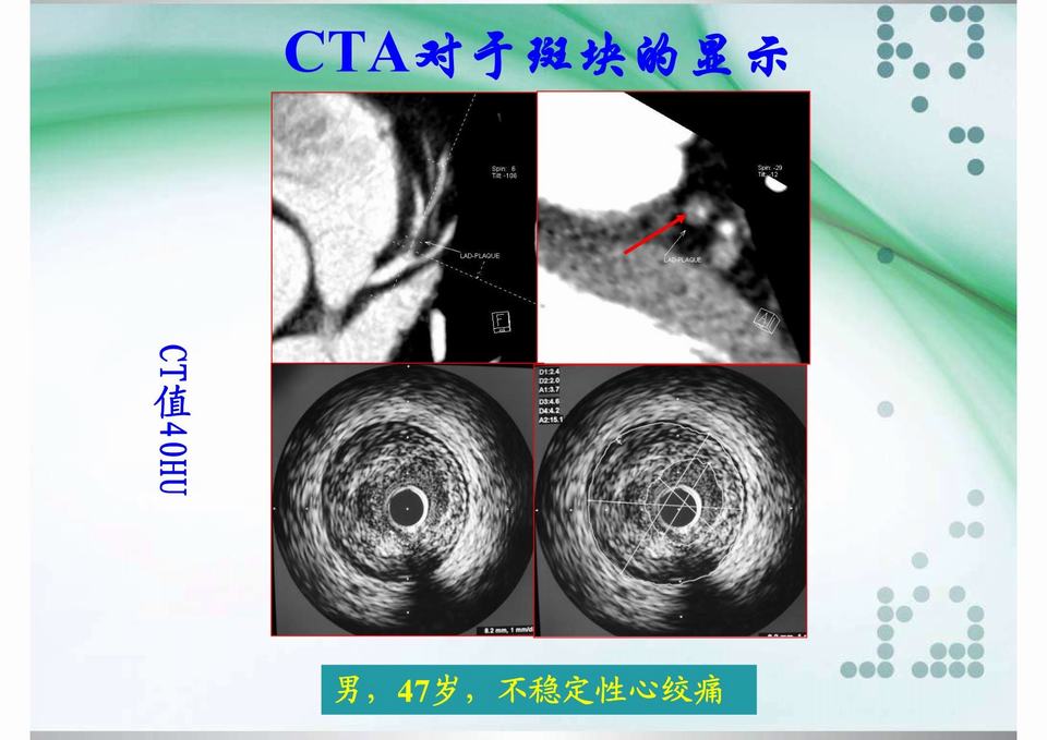 图12