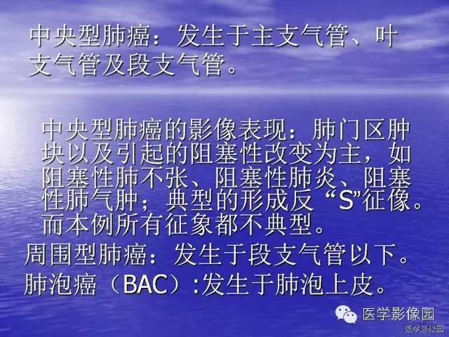 【病例】巨大中央型肺癌1例