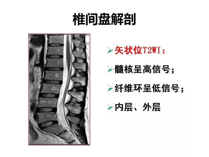 【PPT】腰椎退行性疾病影像学诊断