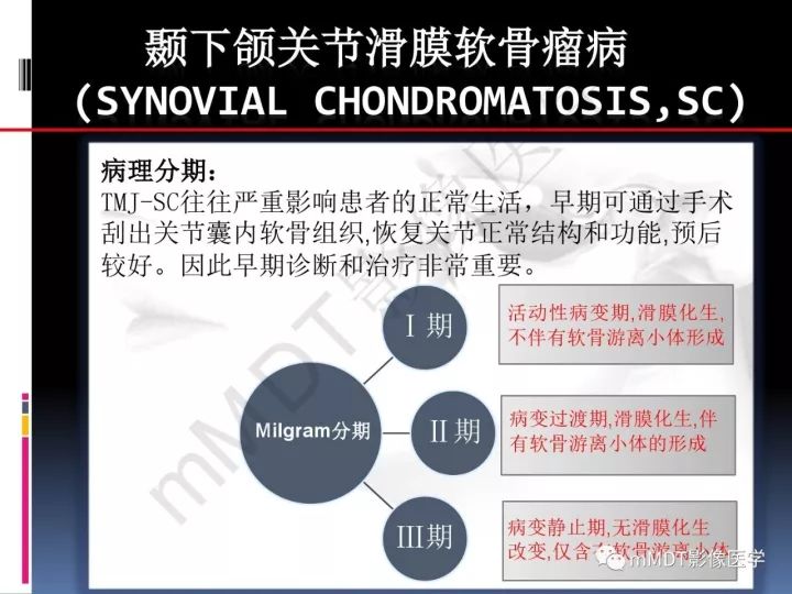 【PPT】颞下颌关节滑膜骨软骨瘤病MR分期诊断