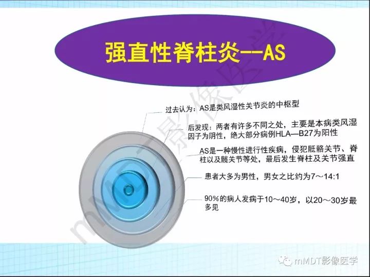 【PPT】骶髂关节非肿瘤病变的影像诊断