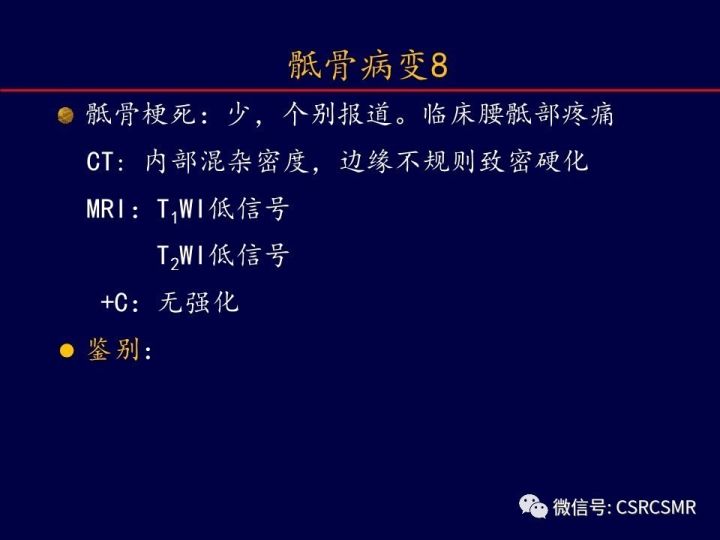 【PPT】骶骨病变的影像诊断与鉴别诊断
