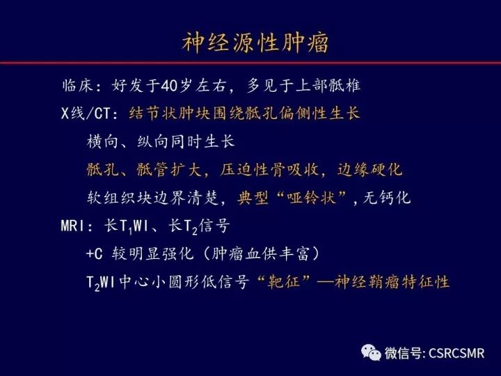 【PPT】骶骨病变的影像诊断与鉴别诊断