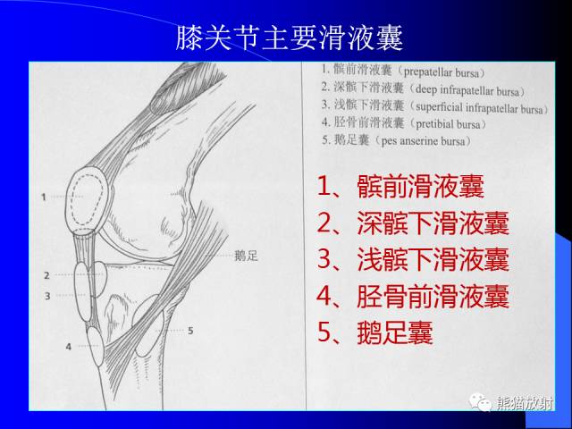 【PPT】膝关节周围囊肿MRI