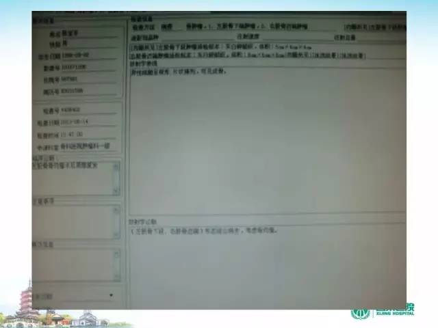 【PPT】骨肉瘤的影像诊断