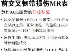 前交叉韧带损伤1例MR影像诊断