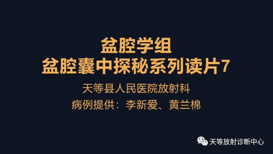 【病例】中肾管囊肿/卵巢冠囊肿1例MR影像-2