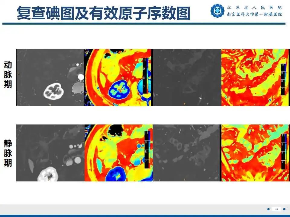 【PPT】克罗恩病-21