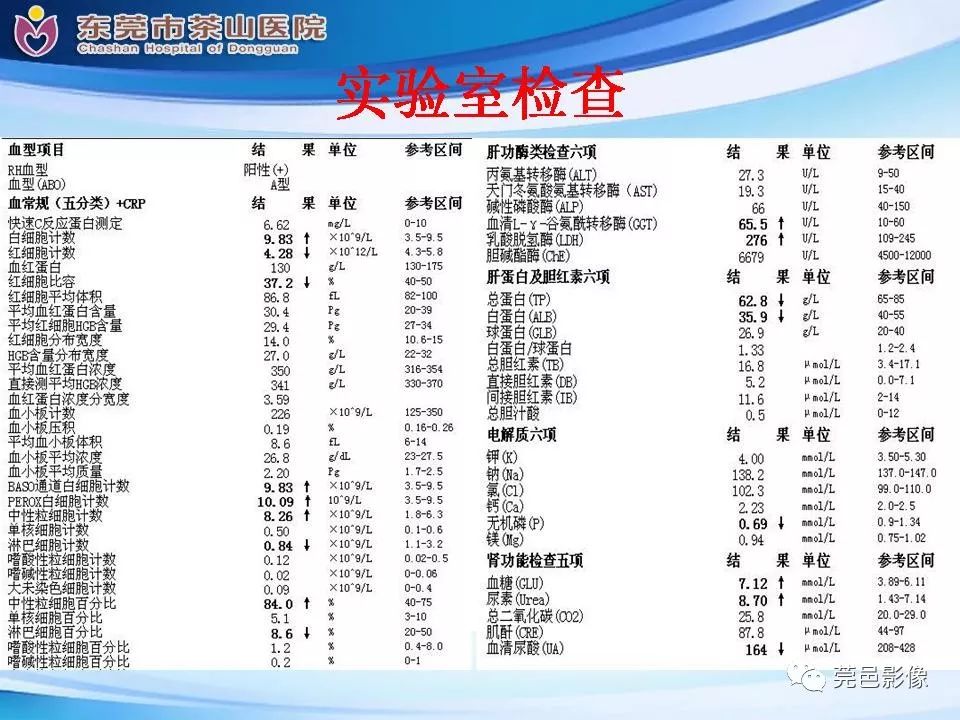 【PPT】腹茧症的影像诊断-4