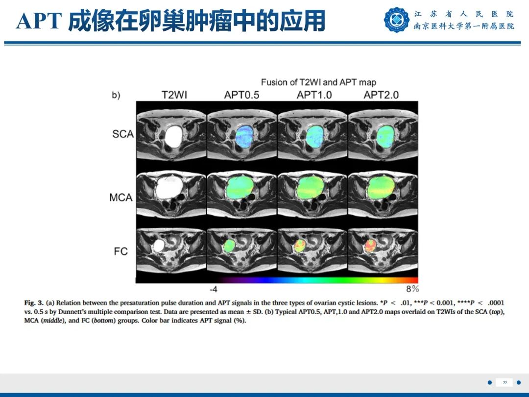 【PPT】输卵管结核-34