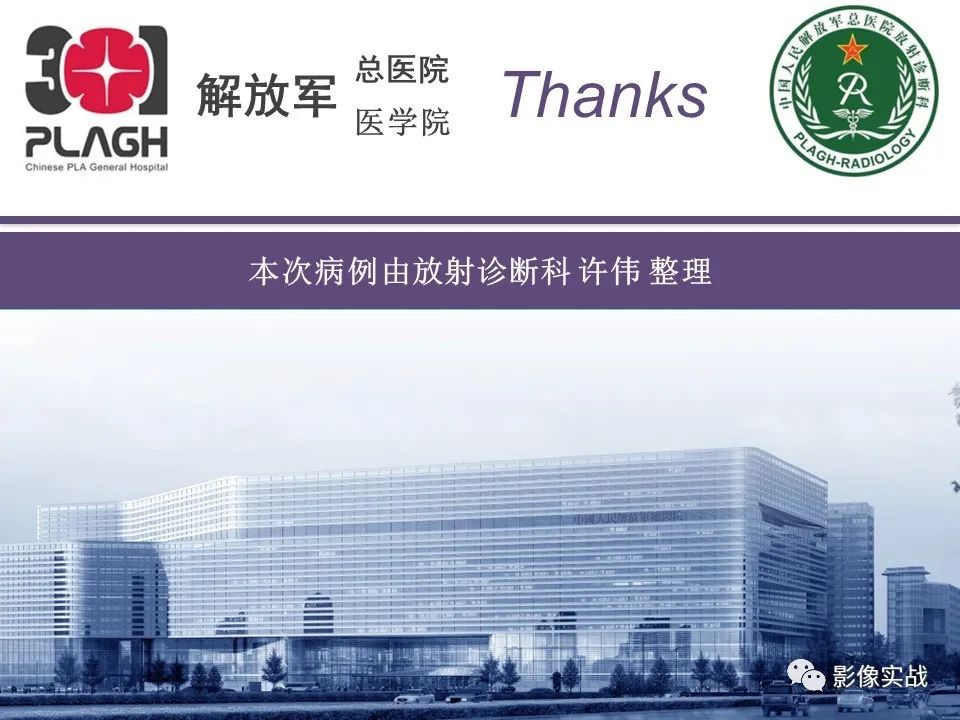 【病例】小肠间质瘤1例CT影像-22