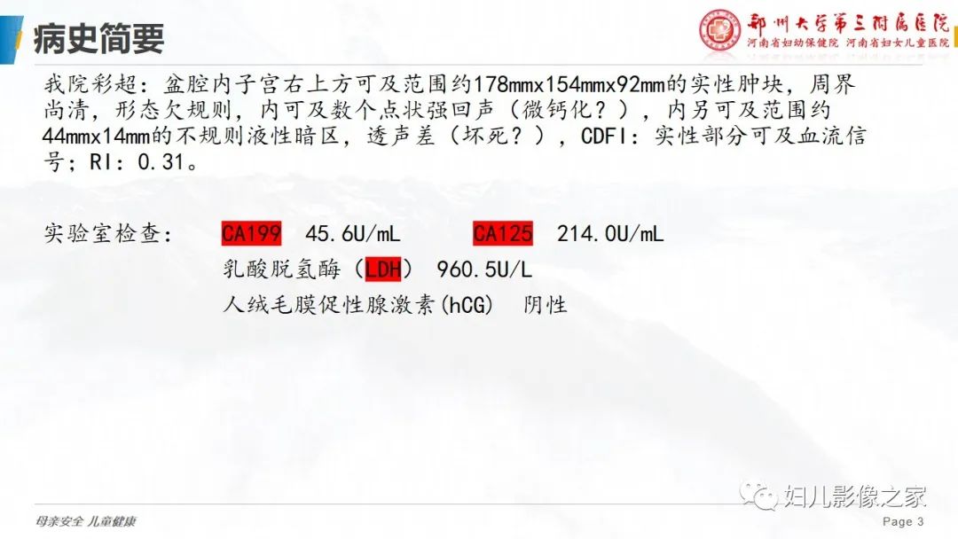 【病例】卵巢无性细胞瘤1例CT及MR影像-3