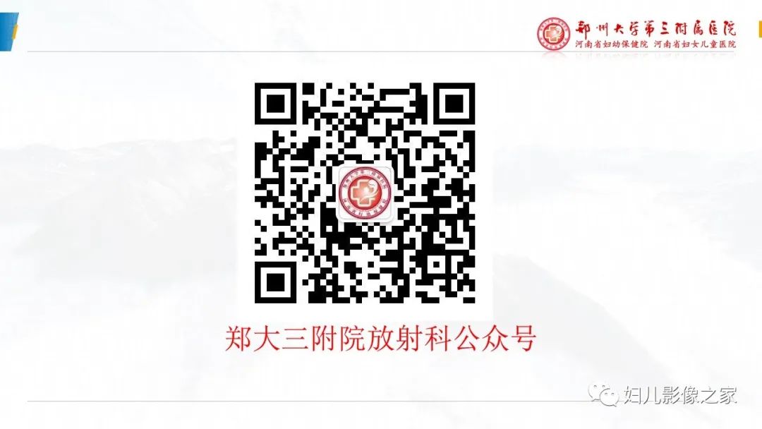 【病例】卵巢无性细胞瘤1例CT及MR影像-18