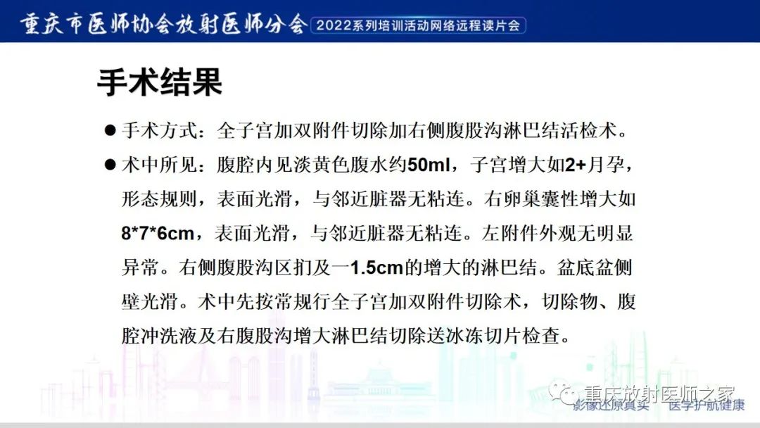 【病例】卵巢黏液性囊腺瘤合并子宫内膜异位1例MR-10