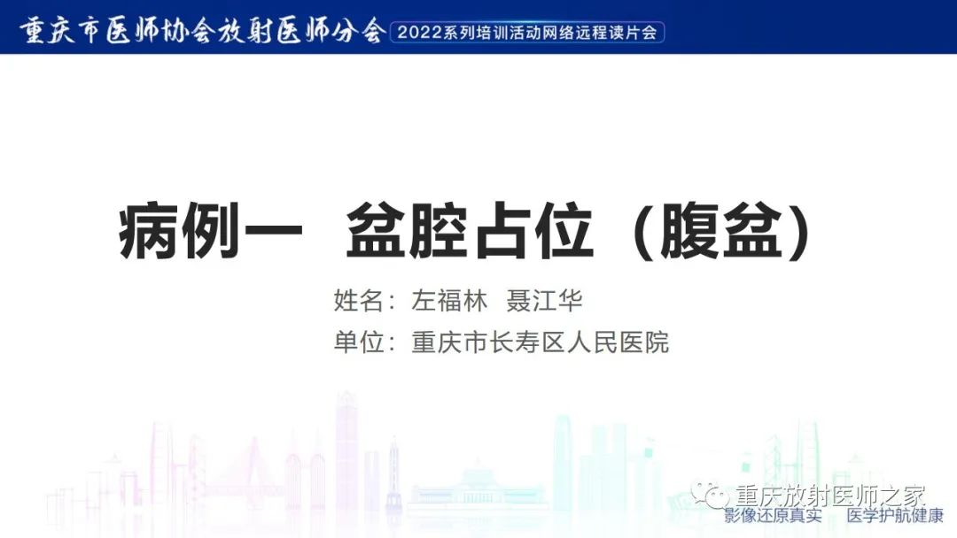 【病例】卵巢黏液性囊腺瘤合并子宫内膜异位1例MR-1