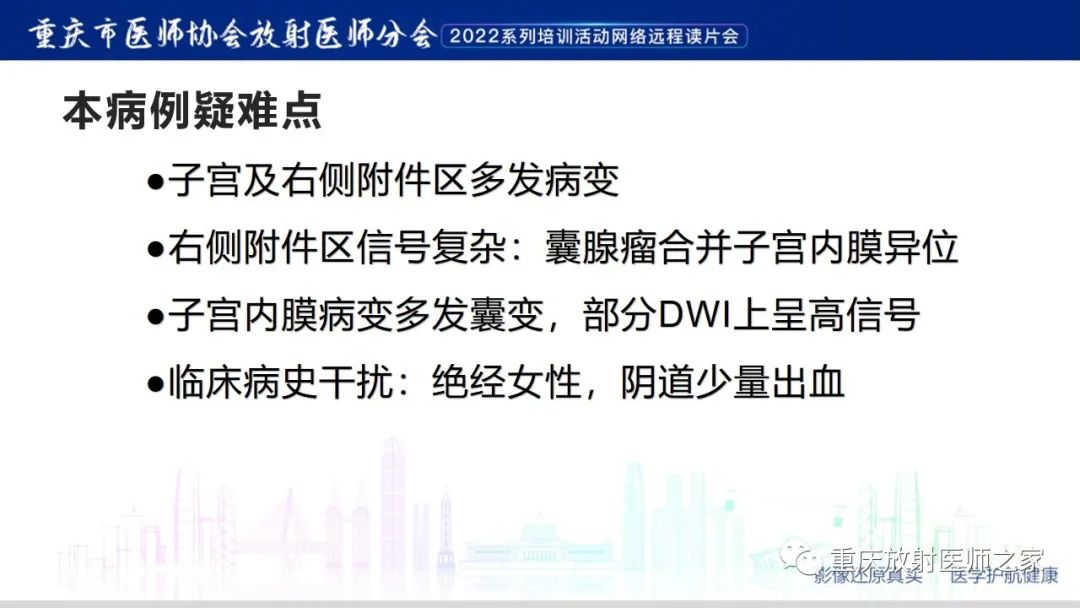 【病例】卵巢黏液性囊腺瘤合并子宫内膜异位1例MR-12
