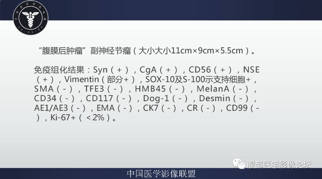 【病例】腹膜后副神经节瘤1例CT影像-9