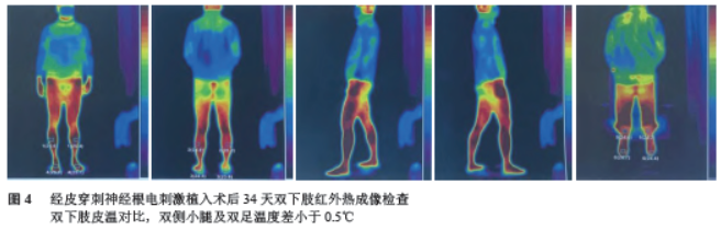 1670283260150833.png
