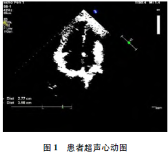 点击查看原图 1.png