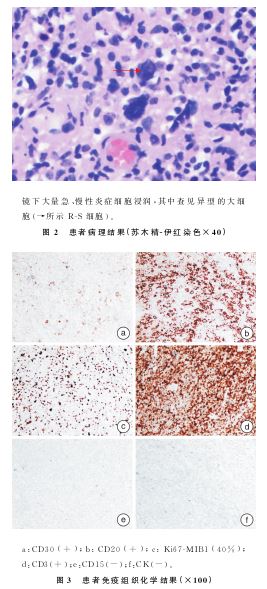 点击查看原图 捕获.JPG